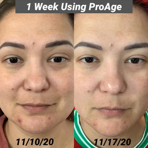 NoFilter ProAge 4 - Night-time Cell Therapy