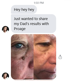 NoFilter ProAge 3 - Day-time Cell Therapy